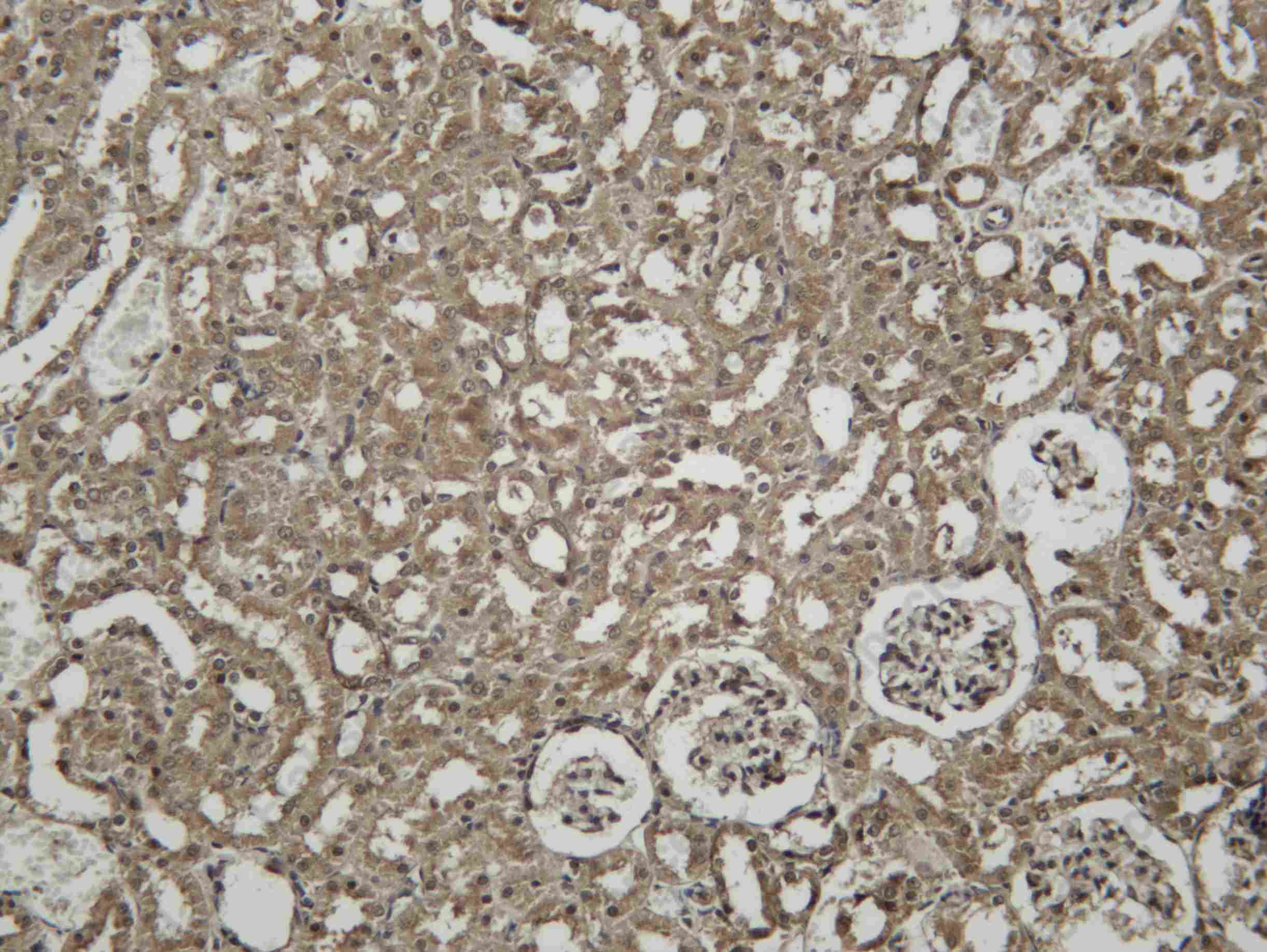 Recombinant Ubiquitin K63 Monoclonal Antibody - 2