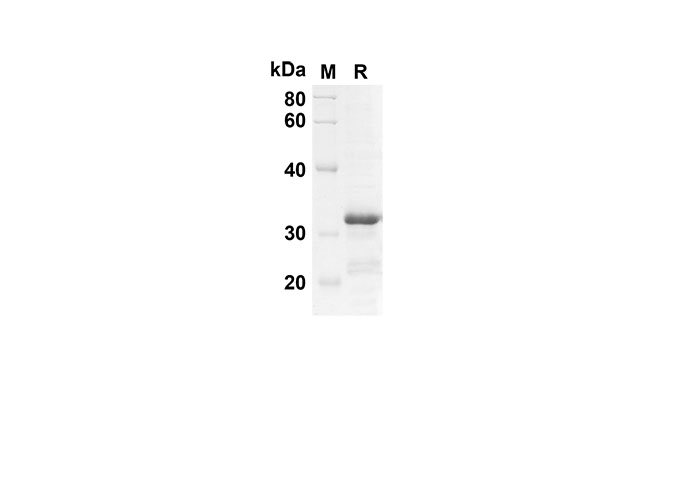 Recombinant Human CDH1 Protein(Trx Tag)-产品推荐-1