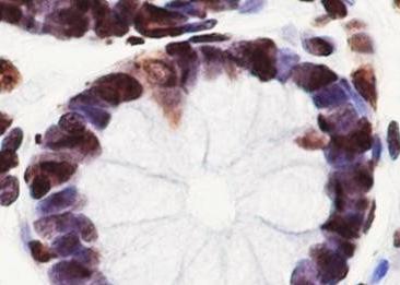 Recombinant Nucleolin Monoclonal Antibody-searchlist-2