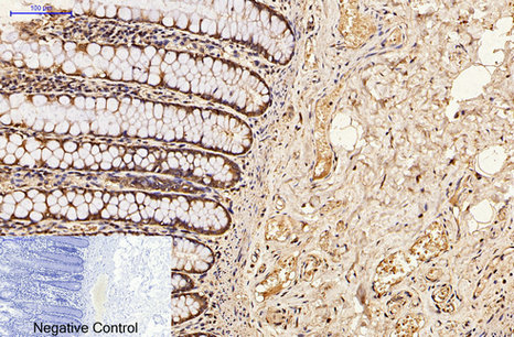 Immunohistochemistry of paraffin-embedded Human colon tissue using CDX2 Monoclonal Antibody at dilution of 1:200.