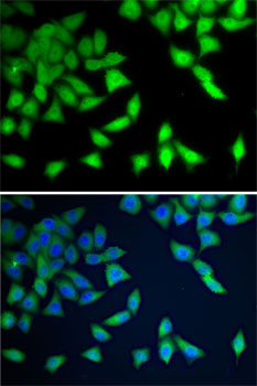 Immunofluorescence analysis of A-549 cells using WDR77 Polyclonal antibody. Blue: DAPI for nuclear staining.