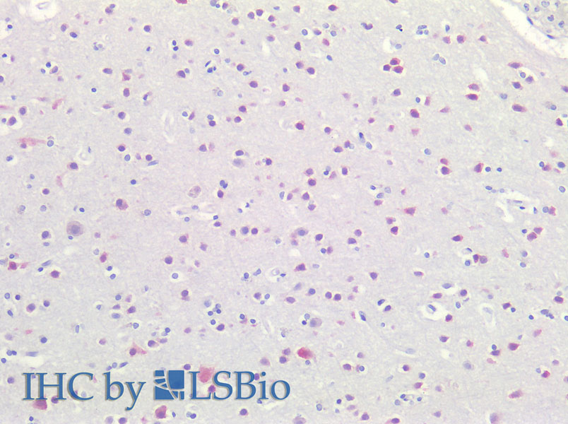 Immunohistochemistry of paraffin-embedded Human Brain using RBFOX3 Polyclonal Antibody at dilution of 1:100(Elabscience Product Detected by Lifespan).