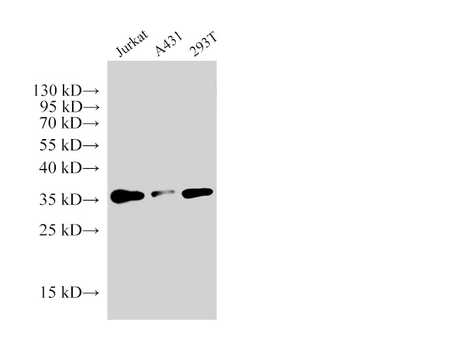 Western Blot analysis of Jurkat, A431 and 293T cells using PCNA Polyclonal Antibody at dilution of 1:6000.