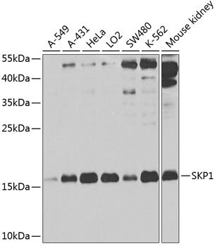 Western blot analysis of extracts of various cell lines using SKP1 Polyclonal Antibody at 1:1000 dilution.