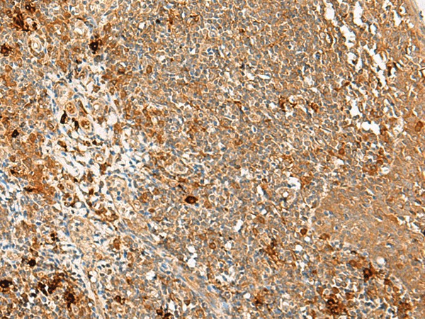 Immunohistochemistry of paraffin-embedded Human tonsil tissue  using METTL17 Polyclonal Antibody at dilution of 1:60(?200)