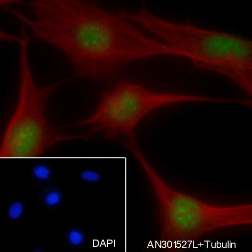 Recombinant FUBP1 Monoclonal Antibody - small - 7