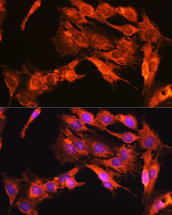 Immunofluorescence analysis of C6 cells using NTRK1/NTRK2/NTRK3 Polyclonal Antibody at dilution of 1:100 (40x lens). Blue: DAPI for nuclear staining.