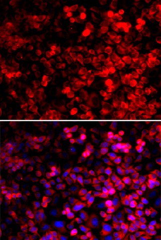 Immunofluorescence analysis of U2OS cells using QARS Polyclonal Antibody