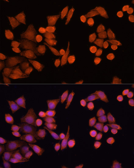 Immunofluorescence analysis of Hela cells using PLA2G4D Polyclonal Antibody at dilution of  1:100 (40x lens). Blue: DAPI for nuclear staining.