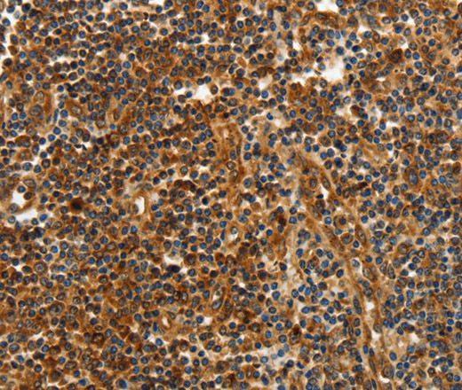 Immunohistochemistry of paraffin-embedded Human tonsil tissue using CNNM3 Polyclonal Antibody at dilution 1:40