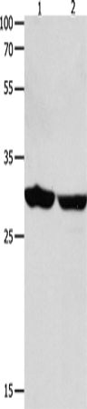 Western Blot analysis of Human brain malignant glioma and laryngocarcinoma tissue using 14-3-3 epsilon Polyclonal Antibody at dilution of 1:1300