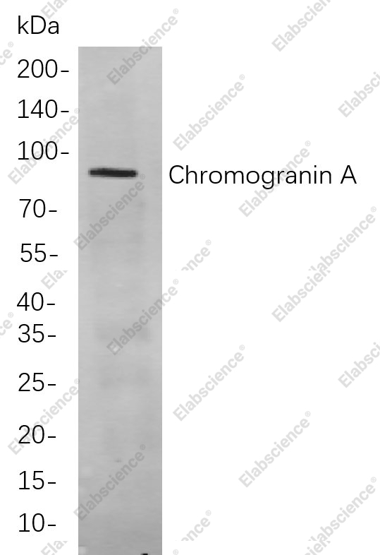 Recombinant Chromogranin A Monoclonal Antibody - 1