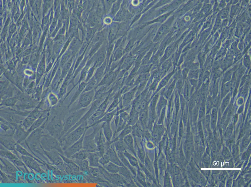 Human Cardiac Fibroblast (Primary cell immortalization) Complete Medium - 6