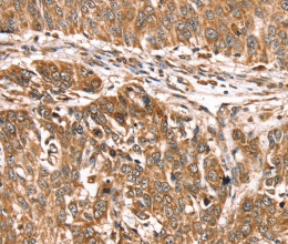 PDLIM4 Polyclonal Antibody - 3