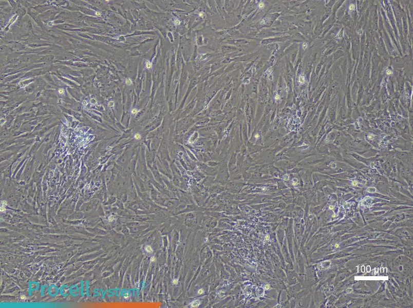 Mouse Uterine Fibroblast Complete Medium - 2