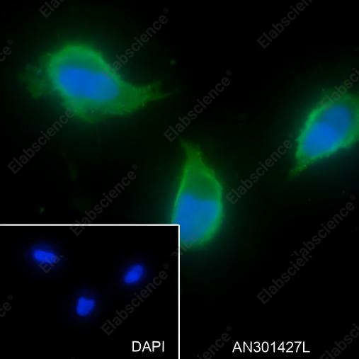 Recombinant Activin A Receptor Type IB/ALK-4 Monoclonal Antibody - 3