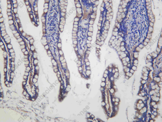 Recombinant PLOD2 Monoclonal Antibody - 2