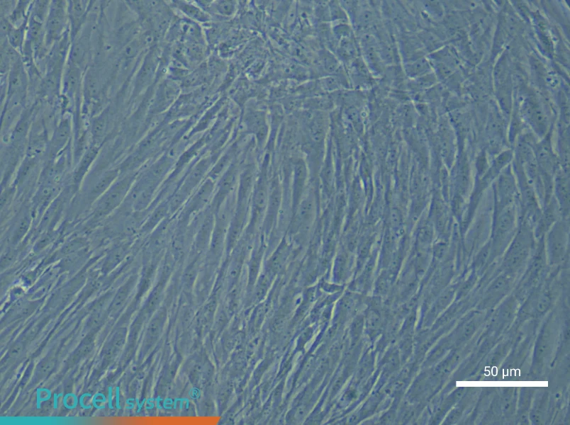 Human Bronchial Smooth Muscle Cell Complete Medium - 5