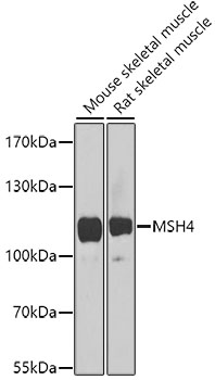 Western blot analysis of extracts of various cell lines using MSH4 Polyclonal Antibody at 1:1000 dilution.