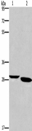 Western Blot analysis of Mouse brain tissue and A172 cell using NRG1 Polyclonal Antibody at dilution of 1:650