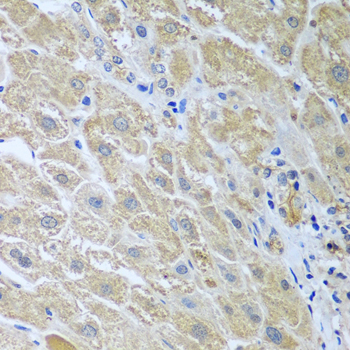 Immunohistochemistry of paraffin-embedded Human liver using WDR48 Polyclonal Antibody at dilution of  1:100 (40x lens).