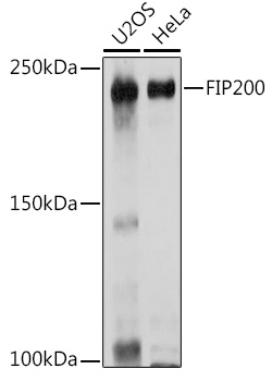 Western blot analysis of extracts of various cell lines using FIP200 Polyclonal Antibody at 1:1000 dilution.