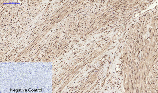 Immunohistochemistry of paraffin-embedded Human uterus tissue  using Phospho-CHEK2 (Thr68) Polyclonal Antibody at dilution of 1:200