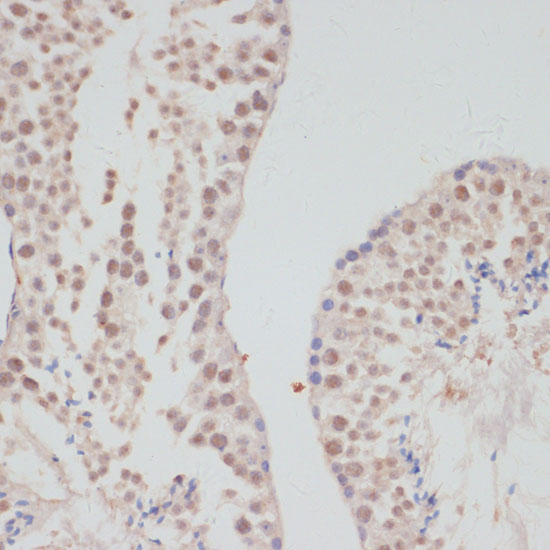 Immunohistochemistry of paraffin-embedded mouse testis using Cyclin G1 Polyclonal antibody at dilution of 1:100 (40x lens).Perform microwave antigen retrieval with 10 mM PBS buffer pH 7.2 before commencing with IHC staining protocol.