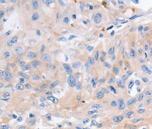 KCNA1 Polyclonal Antibody - 2