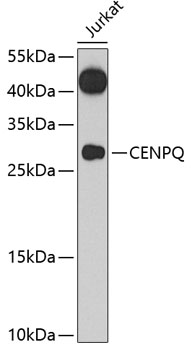 Western blot analysis of extracts of Jurkat cells using CENPQ Polyclonal Antibody at cells using CENPQ Polyclonal Antibody at 1:1000 dilution.