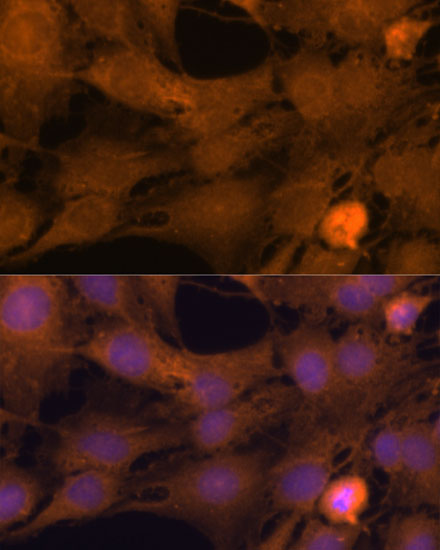 Immunofluorescence analysis of C6 cells using ZC3H7A Polyclonal Antibody at dilution of  1:100. Blue: DAPI for nuclear staining.