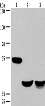 Western Blot analysis of Mouse brain and Human fetal muscle tissue, Mouse heart tissue using CABLES1 Polyclonal Antibody at dilution of 1:650