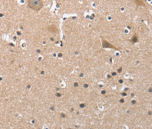 Immunohistochemistry of paraffin-embedded Human brain tissue using BUB1 Polyclonal Antibody at dilution 1:50