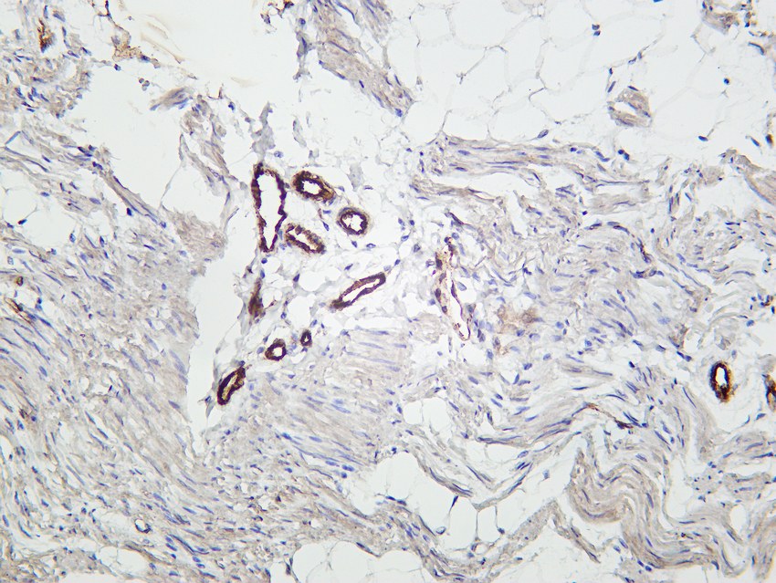 Recombinant TMEM173 Monoclonal Antibody - 3