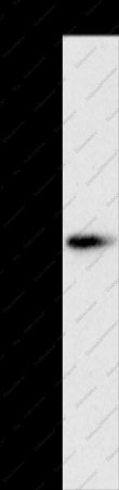 PNLIP Polyclonal Antibody - 1