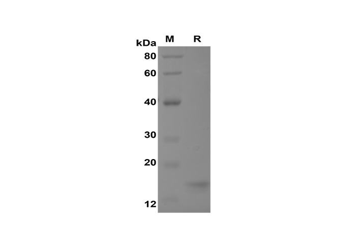 Recombinant Rat IL-2 Protein(His Tag)-searchlist-1
