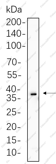 Recombinant SIX2 Monoclonal Antibody - 1