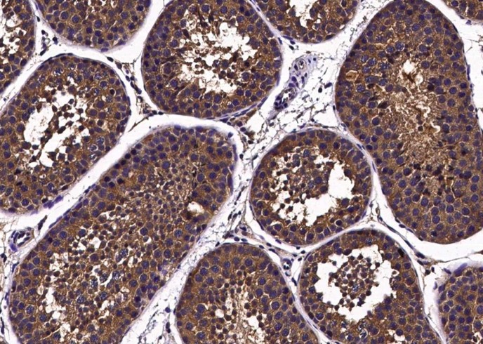 CD113/Nectin-3 Monoclonal Antibody - small - 3