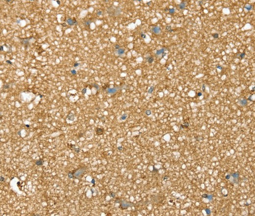 Immunohistochemistry of paraffin-embedded Human brain tissue using SDC3 Polyclonal Antibody at dilution 1:45