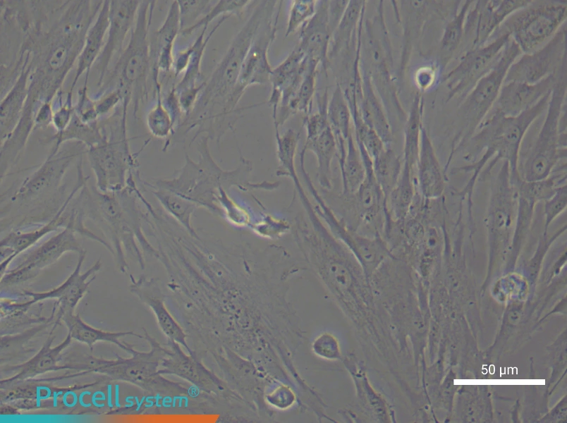 Human Gingival Fibroblast Complete Medium - 5