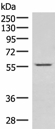 Western blot analysis of Jurkat cell lysate  using IPPK Polyclonal Antibody at dilution of 1:550