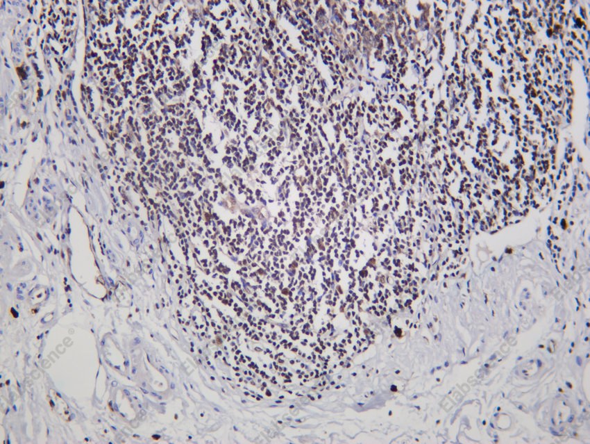 Recombinant FLI1 Monoclonal Antibody - 2