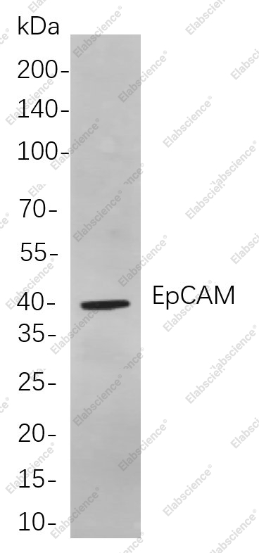 Recombinant EpCAM Monoclonal Antibody - 1
