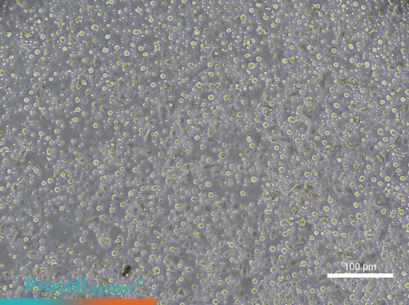 Human Peripheral Blood Maturation Dendritic cell Complete Medium - 2