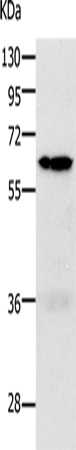 Western Blot analysis of 293T and K562 cell using PAK1 Polyclonal Antibody at dilution of 1:700