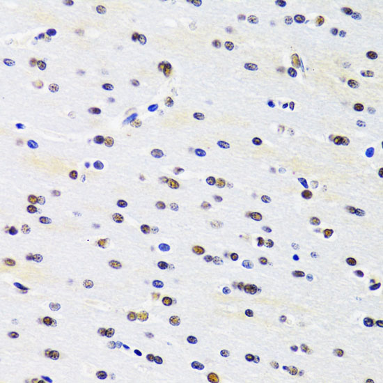 Immunohistochemistry of paraffin-embedded Rat brain using PRPF3 Polyclonal Antibody at dilution of 1:100 (40x lens).