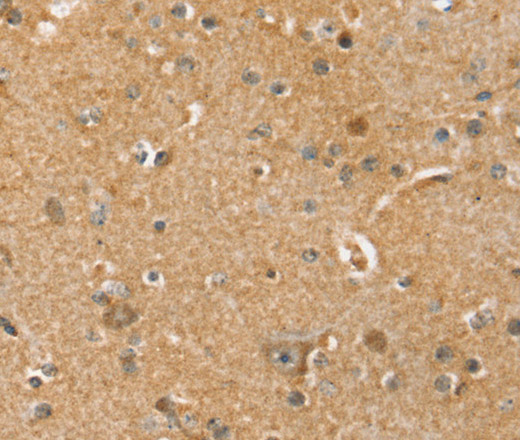 Immunohistochemistry of paraffin-embedded Human brain tissue using SLC41A2 Polyclonal Antibody at dilution 1:45