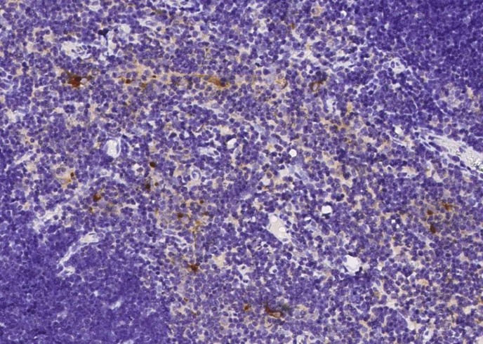 Recombinant B2M/beta-2 microglobulin Monoclonal Antibody-searchlist-1