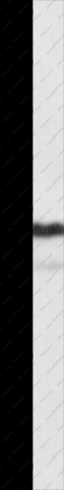 NAP1L1 Polyclonal Antibody - 1