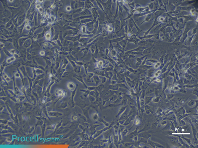 Human Cardiac Microvascular Endothelial (Primary cell immortalization) Cell Complete Medium - 4